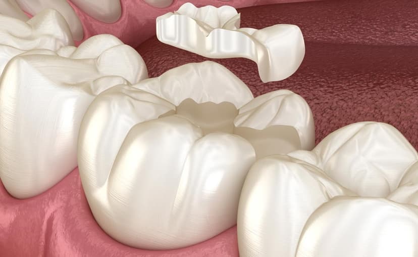 Odontología Rehabilitación